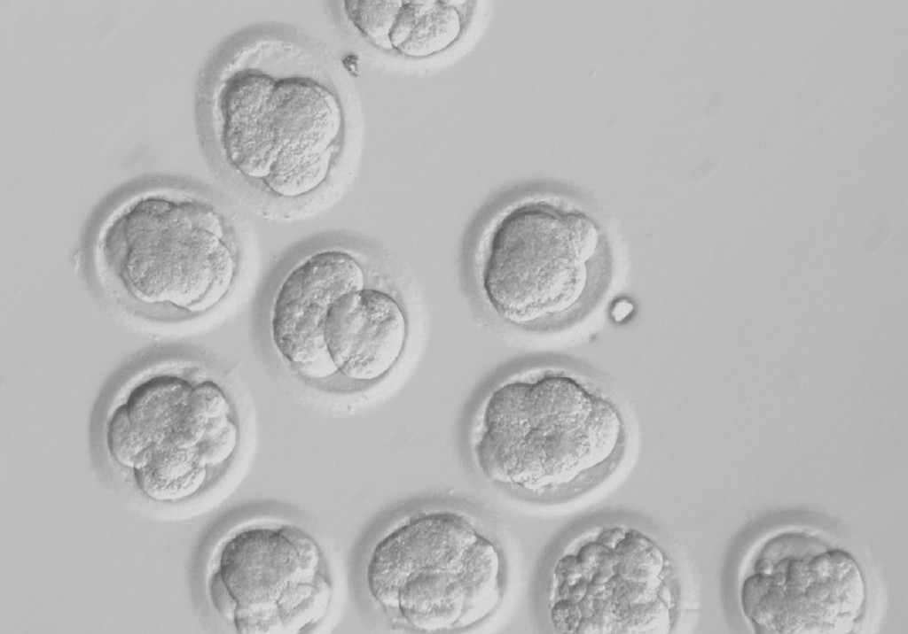 Human embryos created by somatic cell nuclear transfer are pictured on the third day of development in experiments conducted by researchers in Oregon. Utilizing unfertilized eggs from donor women, researchers from Oregon Health & Science University and the Oregon National Primate Research Center were able to reprogram human skin cells to become genetically matching human embryonic cells.  PHOTO: CNS/courtesy of Oregon Health & Science University